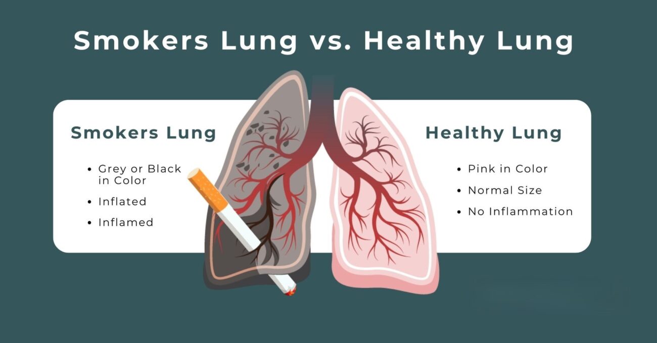 Harmful Health Effects of Cigarette Smoking: Risks, Diseases, and Long-Term Impacts smoking lung vs healthy lung